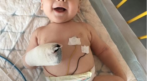 Lou, bébé sourire, malgré tout! (Maladie de Kawasaki, récit de maman)